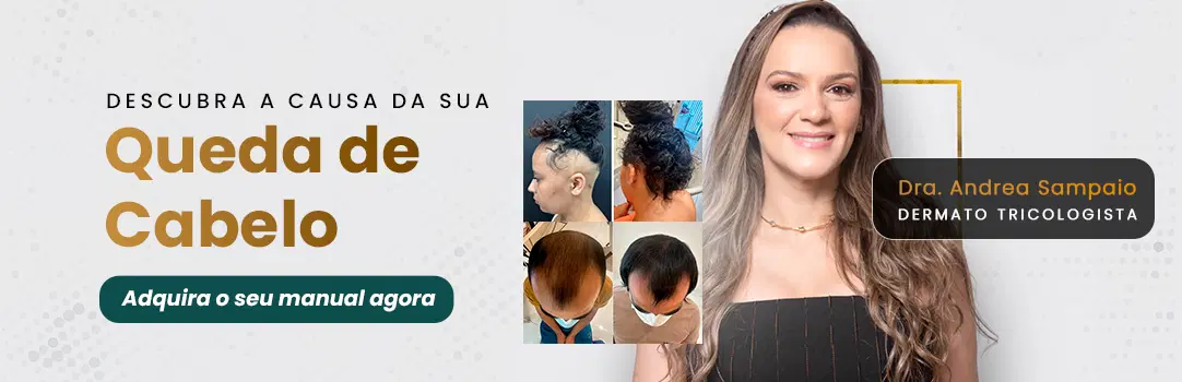 Imagem da oferta