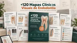 +120 Mapas Clínicos Visuais de Endodontia