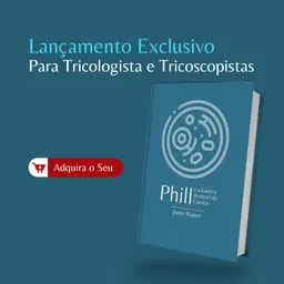 Phill e a Guerra Invisível da Calvície