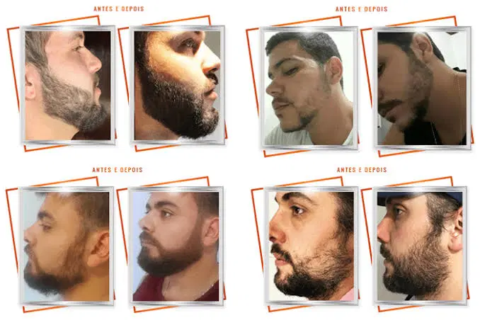 Receita para crescer e dar volume na barba