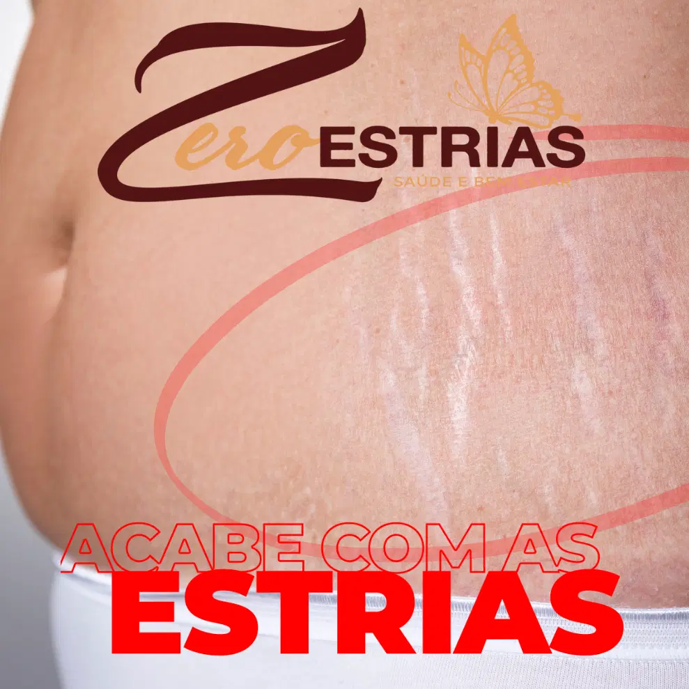 ADEUS ESTRIAS